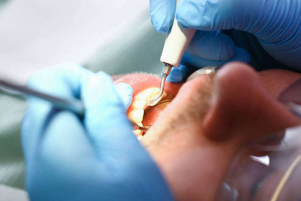 Best Emergency TMJ Treatment in Goshen, CA