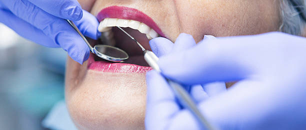 Best Emergency Gum Treatment in Goshen, CA